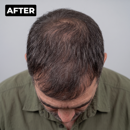 James R. after photo