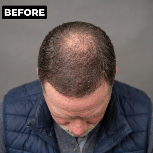 Henry L. before photo