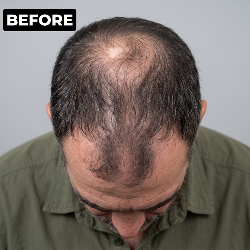 James R. before photo