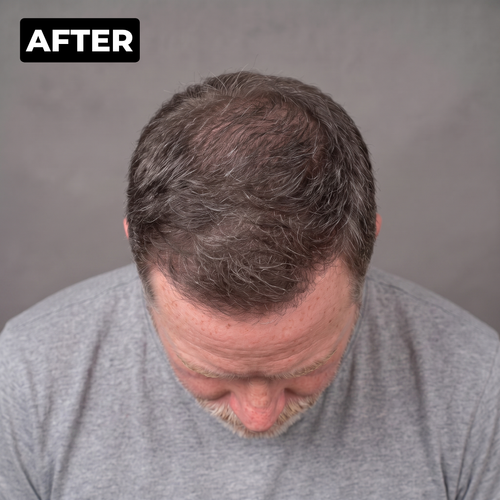 Henry L. after photo